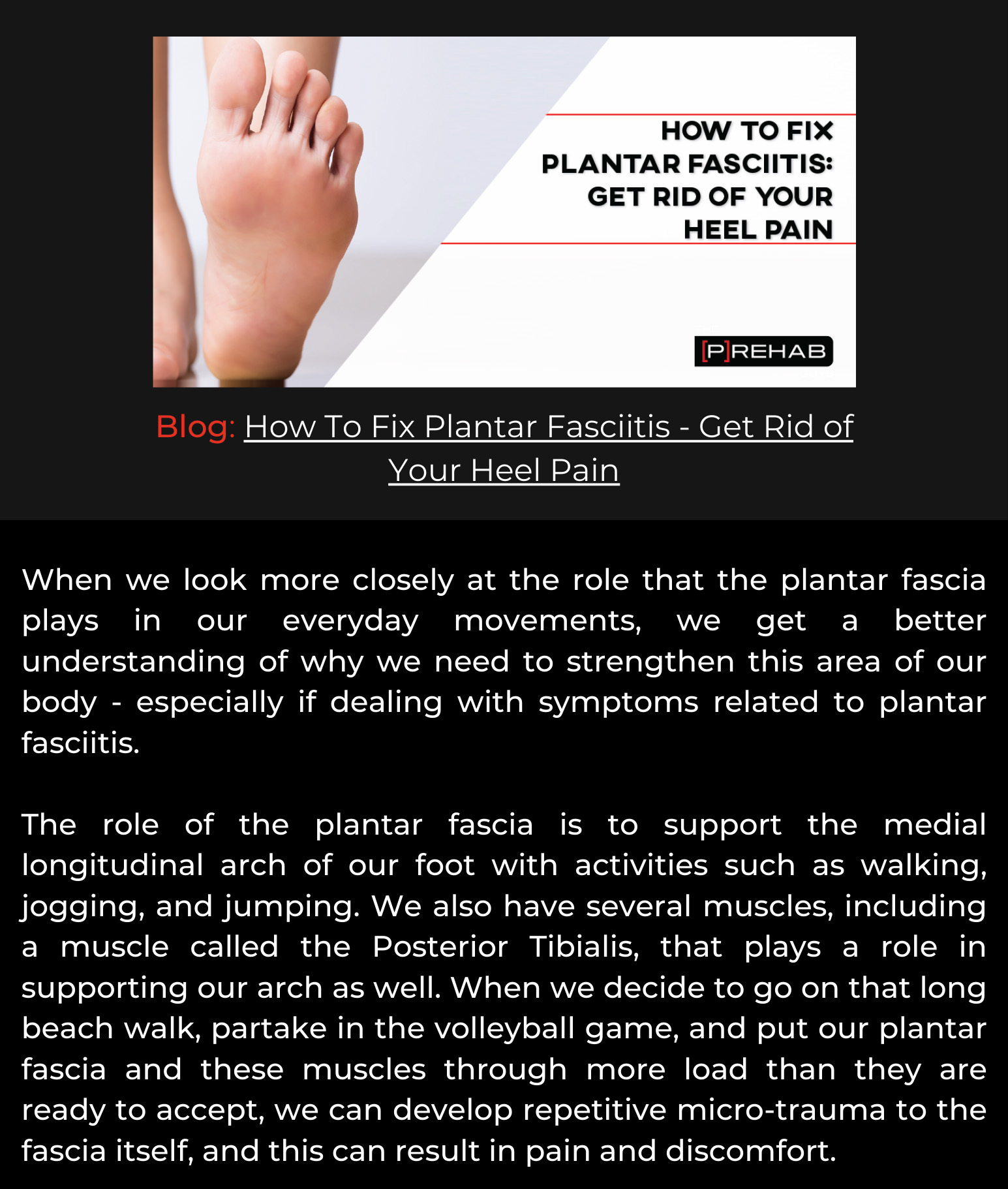 How to get rid of your plantar fasciitis this summer The Prehab Guys